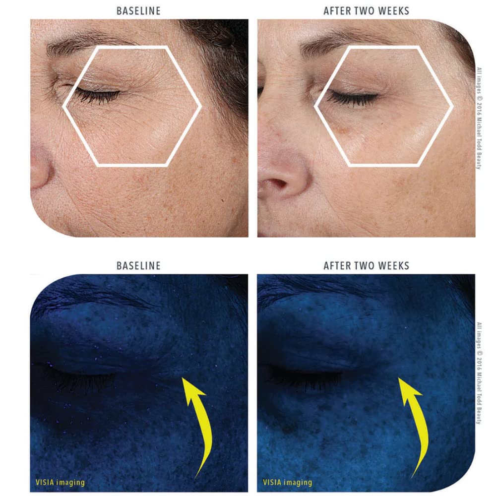 MICHAEL TODD Beauty KNU Cream – Face Lifting, Brightening & Tightening Cream – For Moisturizing & Rejuvenating – With Bakuchiol, Peptides & Snail Secretion – For All Skin Types – 1.68 fl oz/50 mL