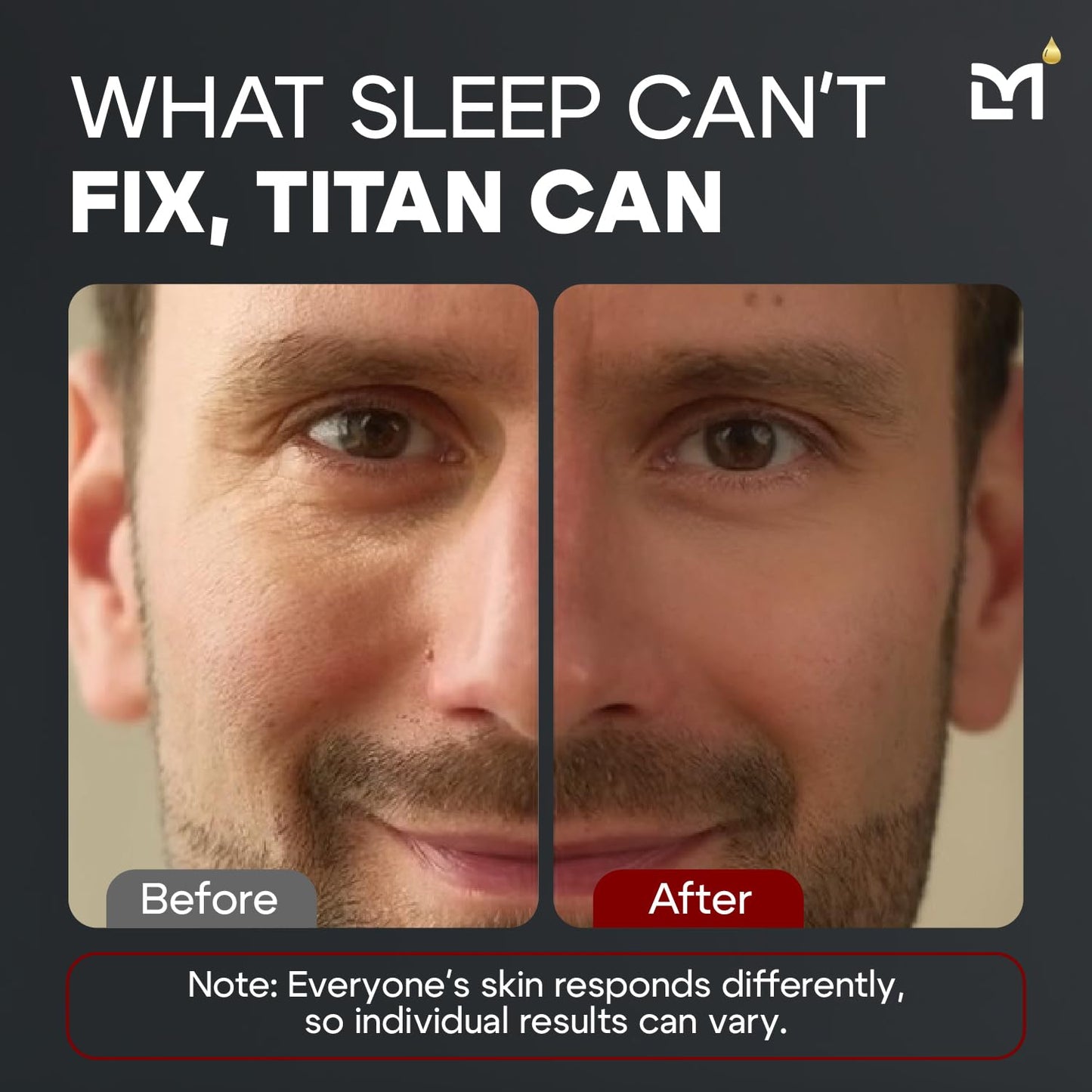 Titan Anti-Aging Mens Eye Cream – Mens Dark Circles Under Eyes Treatment – Eye Bags Treatment for Men – Puffy Eyes Treatments for Men – Peptides, HA, Herbal Extracts –All Skin Types–Unscented