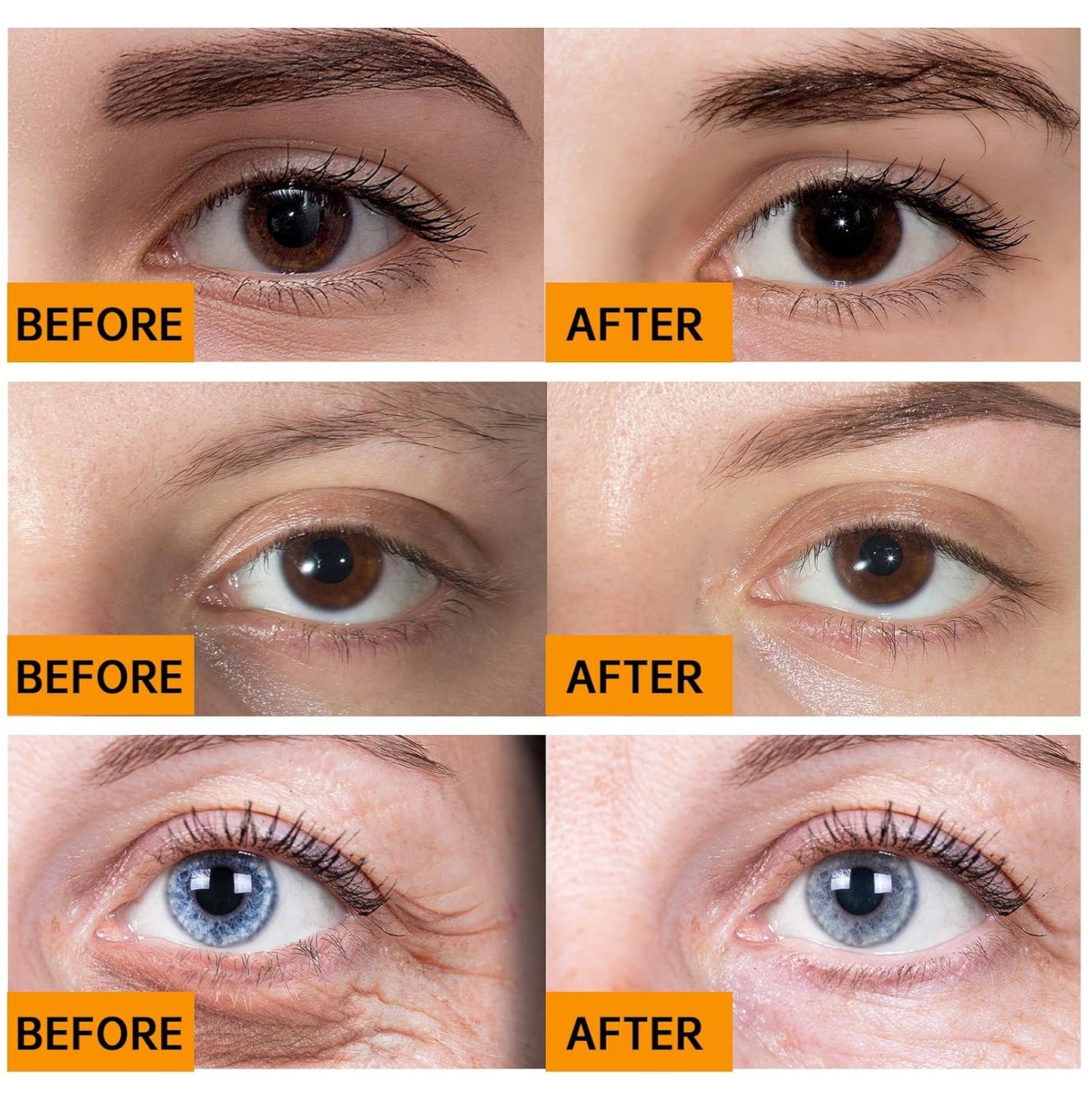 Caffeine Solution 5% + EGCG, Caffeine Eye Serum For Face, 30 ML/ 2 PCS Moisturizing Under Eye Solution For Reduces Dark Circles & Puffiness.