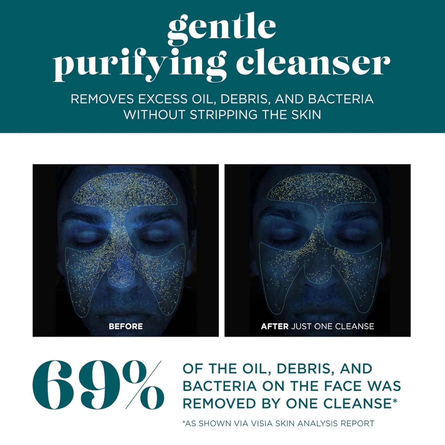 VI DERM Gentle Purifying Cleanser – Hydrating Water-Based Face Wash for Women & Men – Gentle Moisturizing Facial Cleanser with Aloe Vera, Vitamin E & Willow Bark Extract – Fragrance Free, 4 Fl Oz