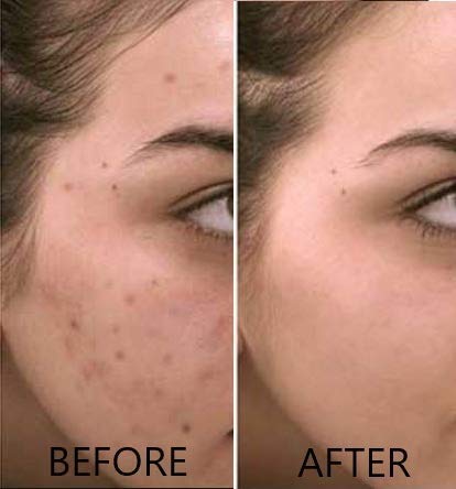 Vitamin C Serum 20% Pure L-Ascorbic Acid, Ferulic Acid, Vitamin E and HA and Hyaluronic Acid Serum with Vitamin B5 for Face and Eyes Natural Anti Aging Anti Wrinkle Set of 2 by Dr. Brenner