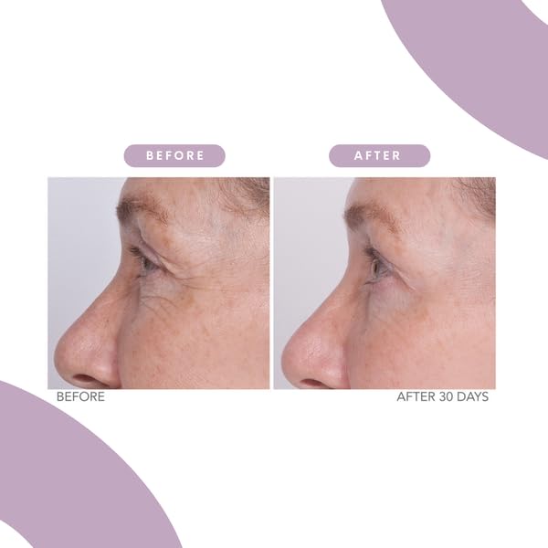 Serious Skincare - Reverse Lift Eye Cream Moisturizer with Peptides, Bladderwrack Seaweed - Skin Firming and Lifting Wrinkle Formula - Women, Men - Temporarily Lift & Firm Eye Area - 1 oz.