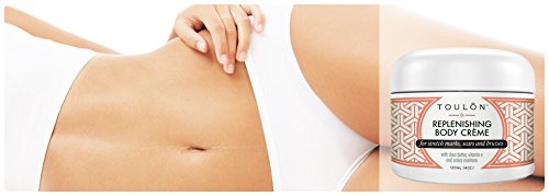 Bruise Cream with Arnica Montana, Shea Butter & Vitamin E: Repair Bruises, Stretch Marks Cream & Scars: 4 oz. For Women and Men