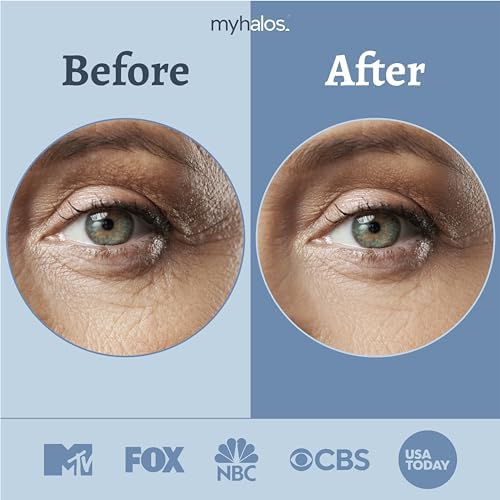 MyHalos Eye Masks for Dark Circles and Puffiness & Eye Patches for Wrinkles Duo- 24 Under Eye Patches for Puffy Eyes, Dark Circles - Eye Mask Skincare Eye Gel Pads - Under Eye Mask Patches Blue, Gold