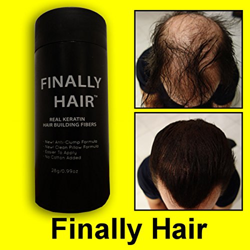 Hair Loss Concealer by Finally Hair - Auburn 28g Bottle of Fibers and Finally Hair 120ml 4.1 oz. Bottle of Fiber Lock Hair Spray - (Auburn)