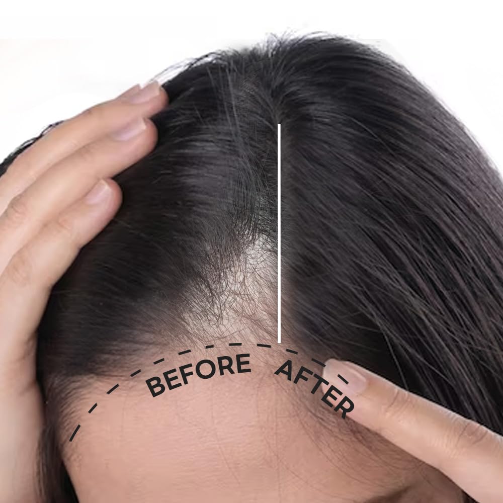 Scalp Intensive Shampoo with Biotin | Korean Shampoo for Hair Loss, Hair Regrowth, Thinning Hair, Volume Boost & Damage Repair (13.52 fl oz)