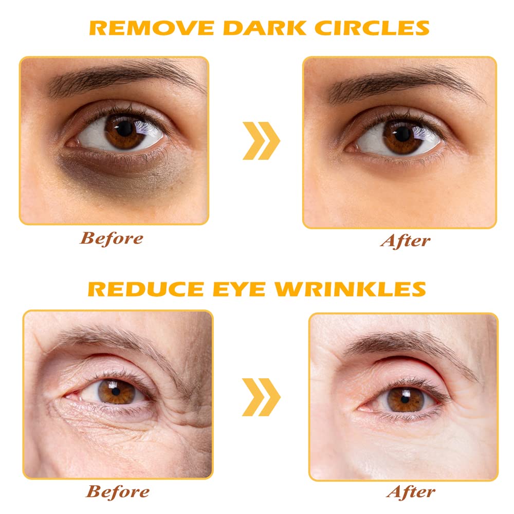 24K Gold Eye Mask, 30 Pairs Under Eye Masks for Dark Circles and Puffiness Treatment, Under Eye Patches for Puffy Eyes and Eye Bags, Gel Eye Mask Eye Pads for Face Skin Care