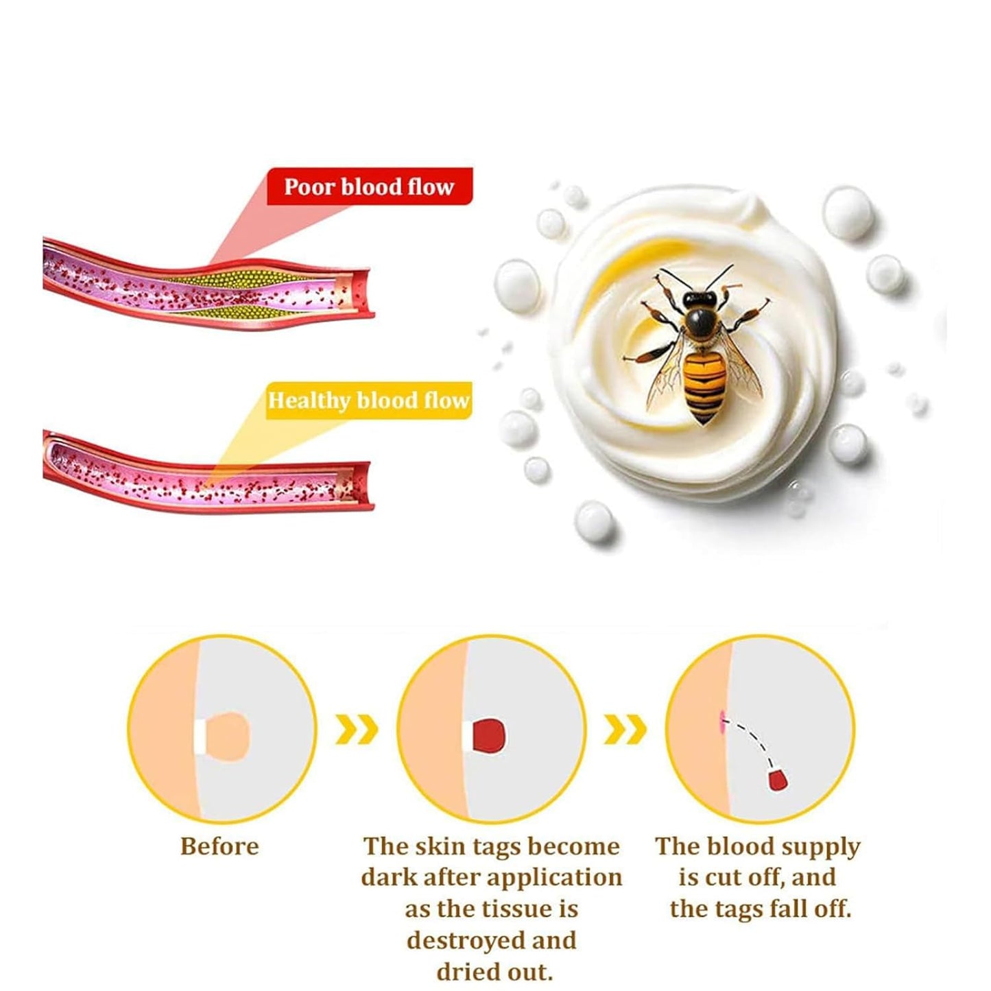 Bee Venom Skin Treatment Cream, Bee Venom Repair Cream, Suitable for All Skin Types