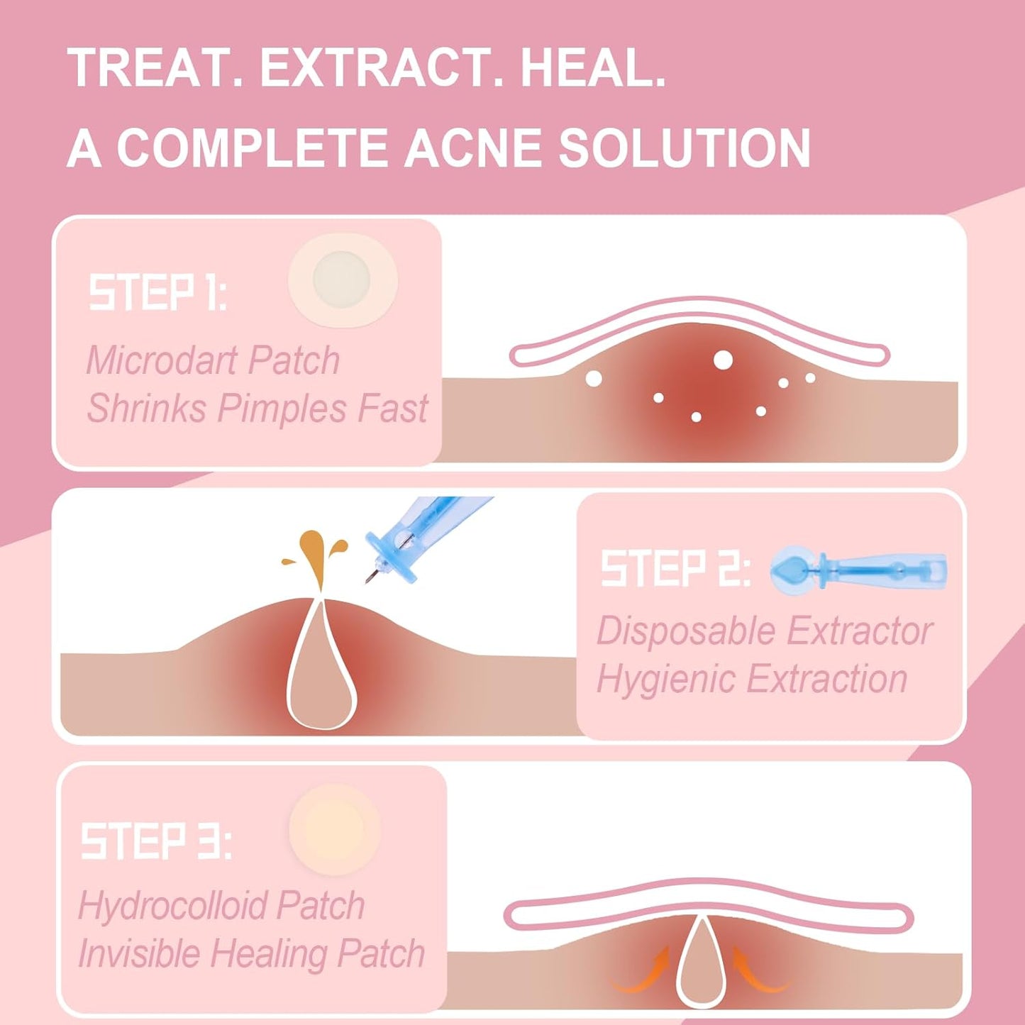 Pimple Patches Set with Microdart Pimples Patche and Hydrocolloid Patch – 3-Step Acne Kit for Fast Blemish Removal, Blackhead Extractor Tools, Zit Patches for Face