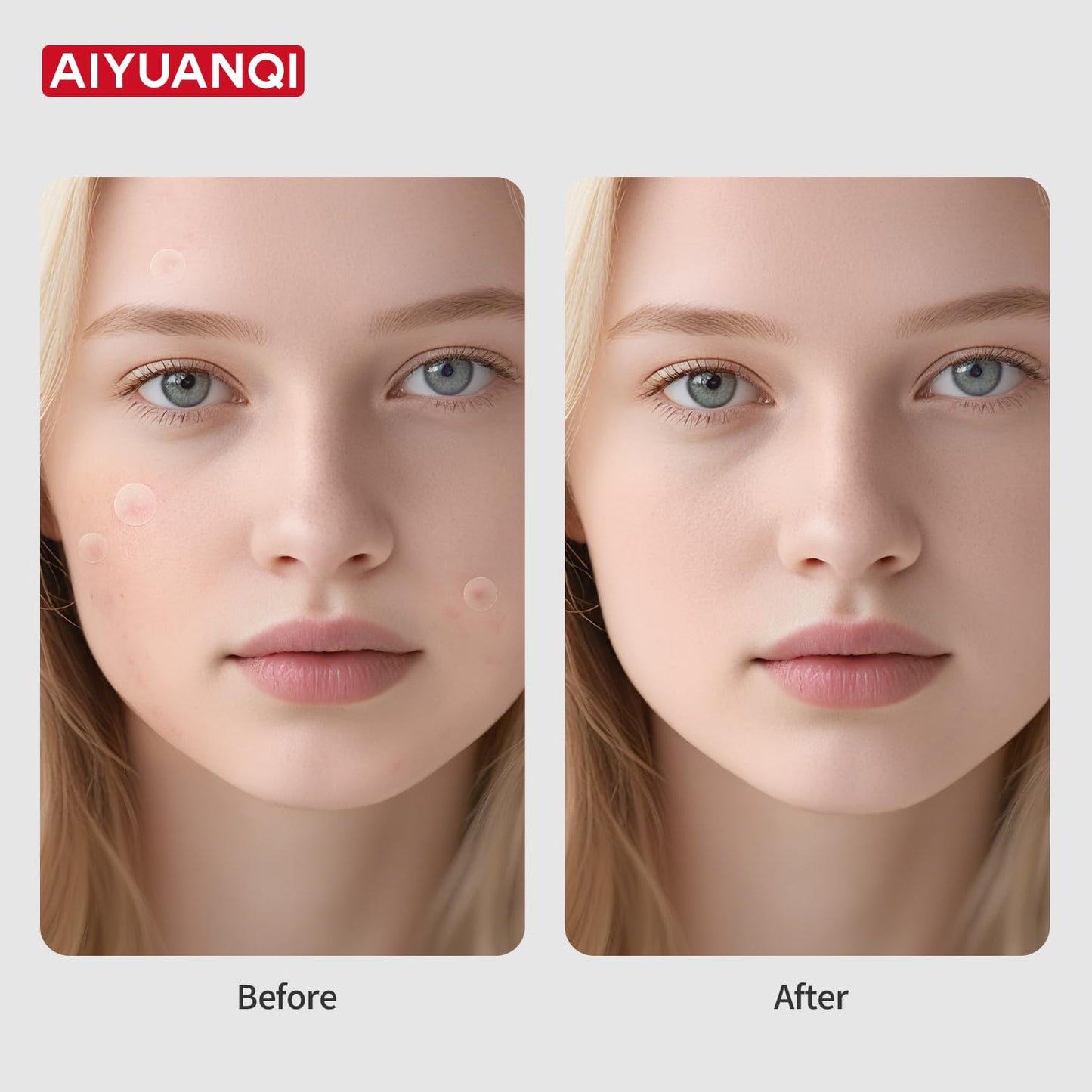 Large Pimple Patches For Face, Invisible Hydrocolloid Acne Patches, Salicylic Acid & Tea Tree, 2 Sizes 180 Counts Spot Stickers for Covering Zits and Blemishes