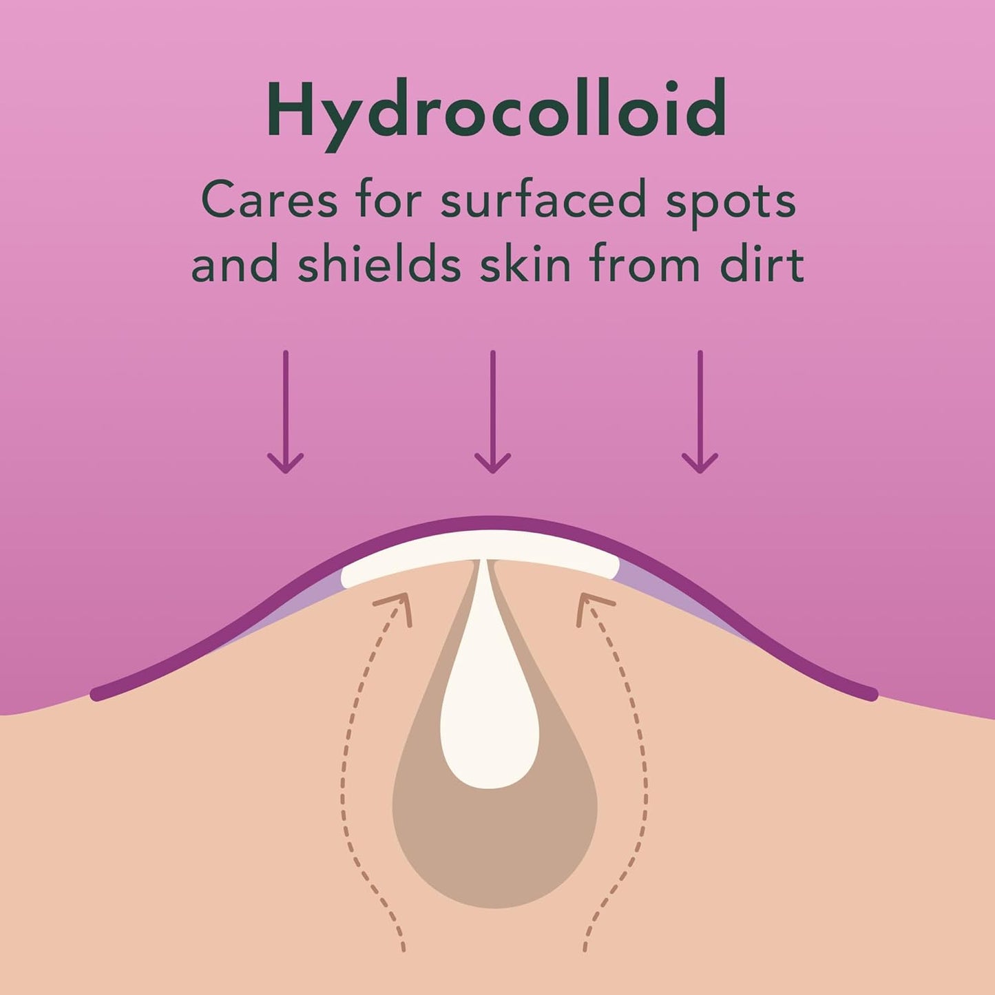 Rael Pimple Patches - Miracle Overnight Spot Cover, Thicker & Extra Adhesion, Hydrocolloid Acne Treatment for Face, Zits & Blemishes, Korean Skin Care, Vegan & Cruelty-Free, 3 Sizes (52 Count)