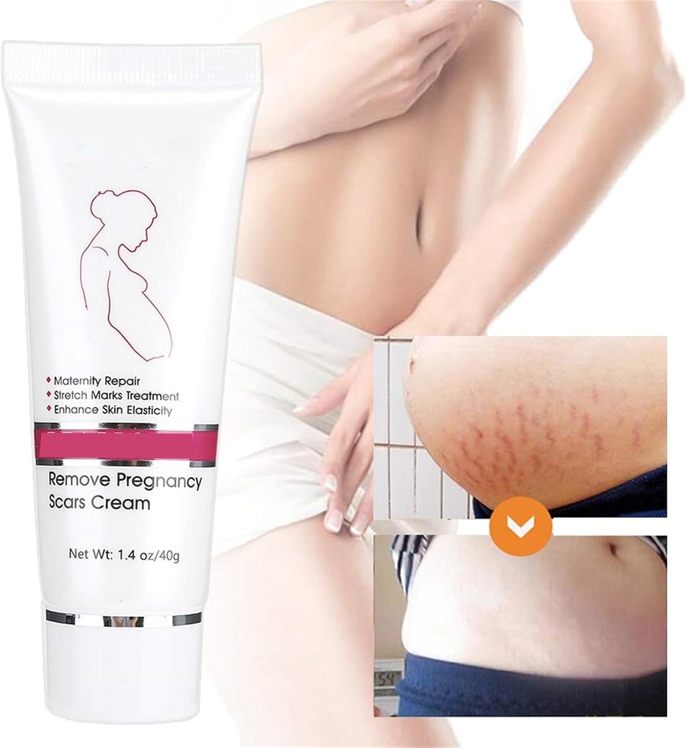 RtopR Stretch Marks and Scar Cream,Crema para Estrias De Embarazo,Stretch Marks Postpartum Repairing Cream Wrinkles Diluting Removal Cream Crema De Cacao para Cicatrices