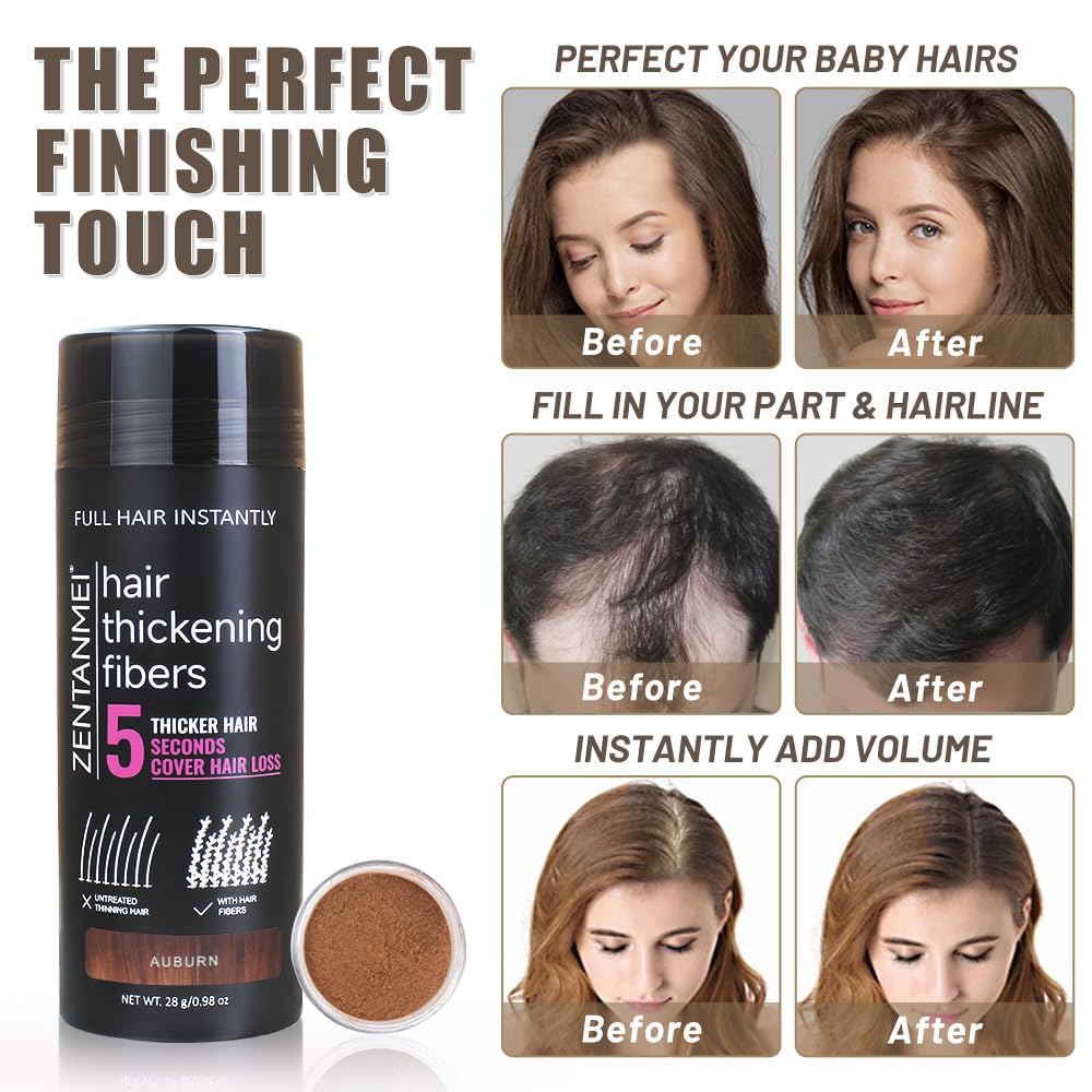 Hair Fibers for Thinning Hair for Women All-Natural Hair Building Fibers 0.98 Oz Hair Volume Powder Bald Spot Cover Up for Men & Women (Medium Blonde)