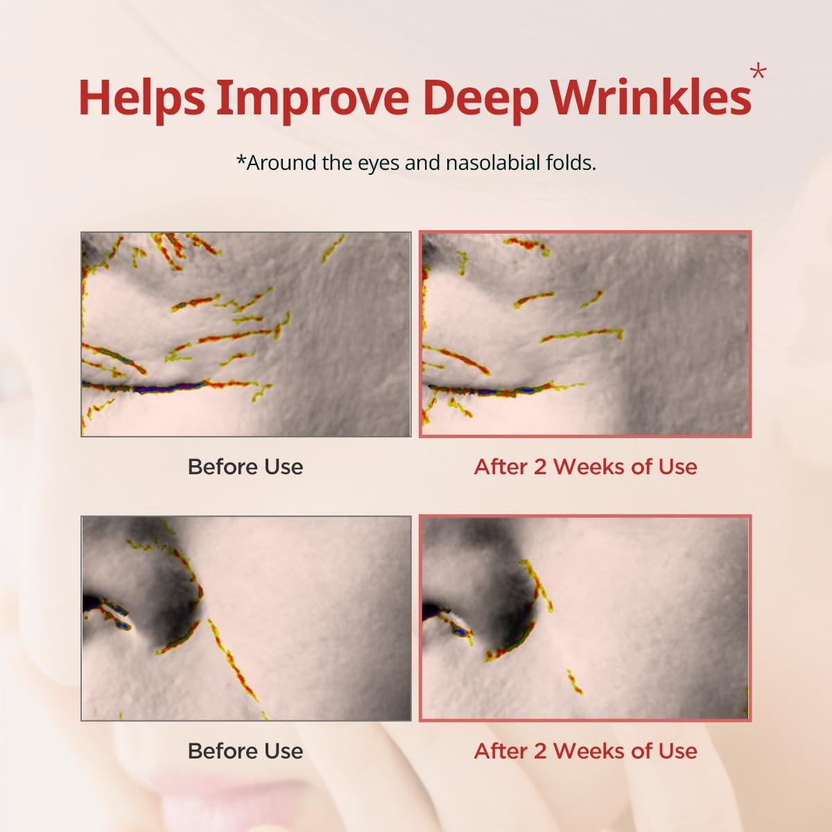 DERMATORY Pro Vita-A Retinal Under Eye Patch (60 sheets) | Reduces Dark Circles & Puffiness, Brightening, Hydrogel Ampoule, For Fine Lines & Wrinkles, With Retinal, Reallagen, Bakuchiol, Volufiline