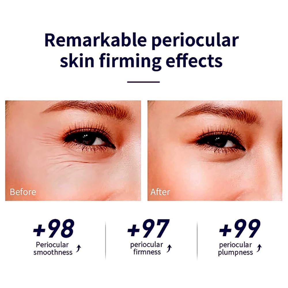 Snail Peptide Eye Serum, Under Eye Roller Cream to Reduce Dark Circles Puffiness Wrinkles Fine Lines, Niacinamide Eye Essence with 360° Massage Ball, Roll-On for Moisturizing Firming (SNAIL MUCIN)