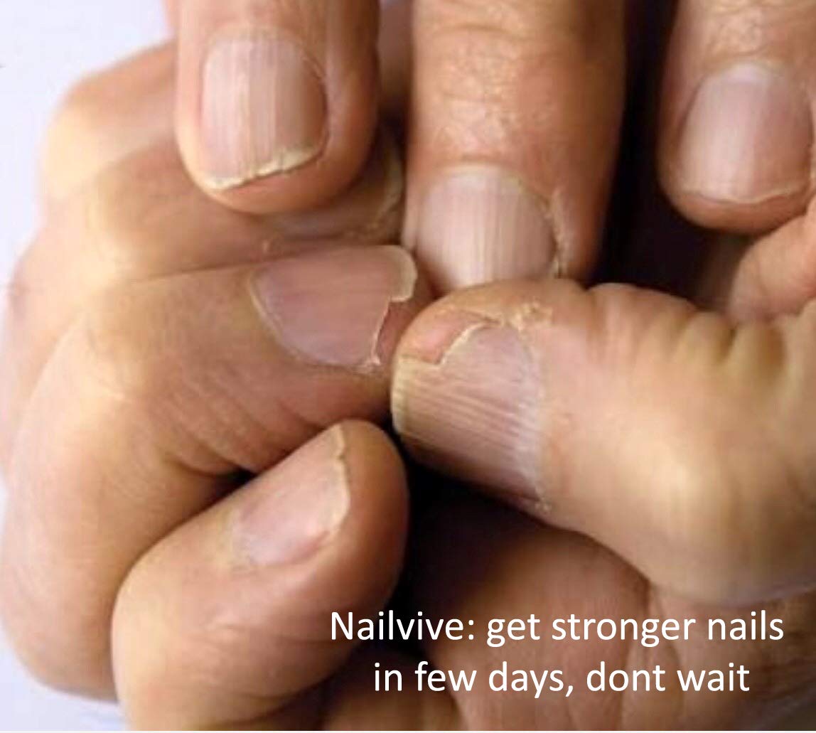 NAILVIVE Nail Serum Powerful Magic-like Silk Proteins Proven Natural Formula Strengthening Hardening nails Instantly Prevents Splits Chips Peels Cracks on Your Nails (BOTTLE APPLICATOR)