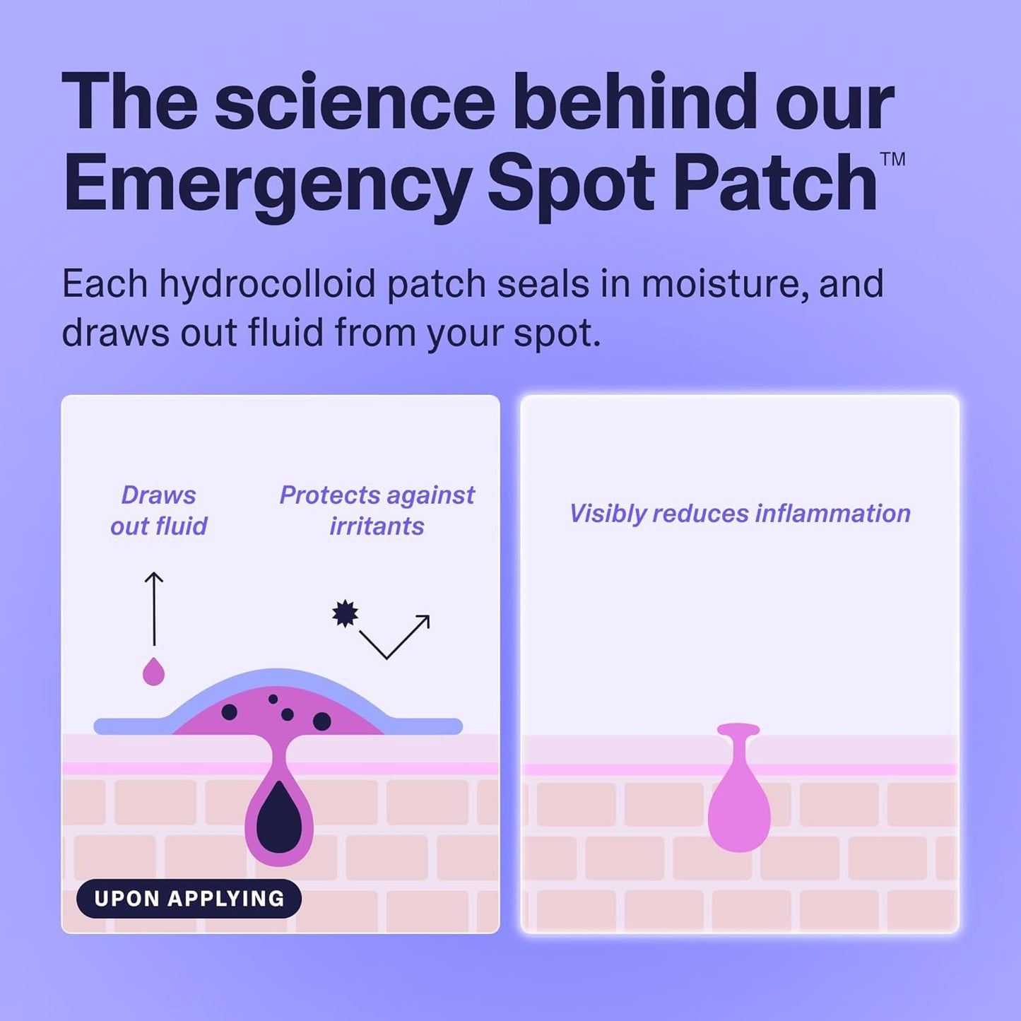 Curology Essentials Bundle, Emergency Spot Pimple Patches for Face, Gentle Facial Cleanser, and Lightweight Gel Face Moisturizer