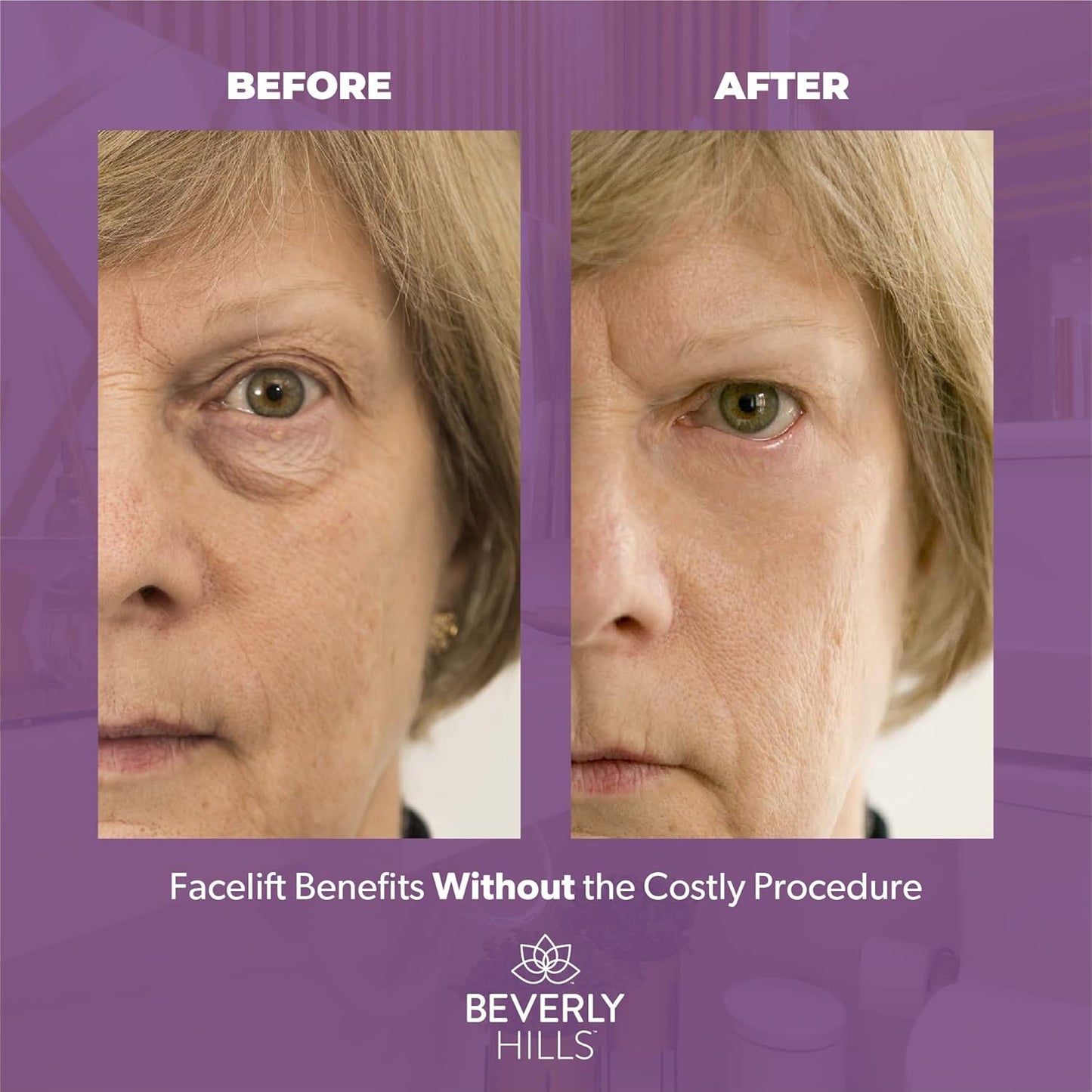 Beverly Hills Instant Facelift Anti Aging Eye Serum Treatment for Dark Circles, Puffy Eyes, Wrinkles, Under Eye Bags, Fine Lines, and Crows Feet | 30mL (120 Days Supply)