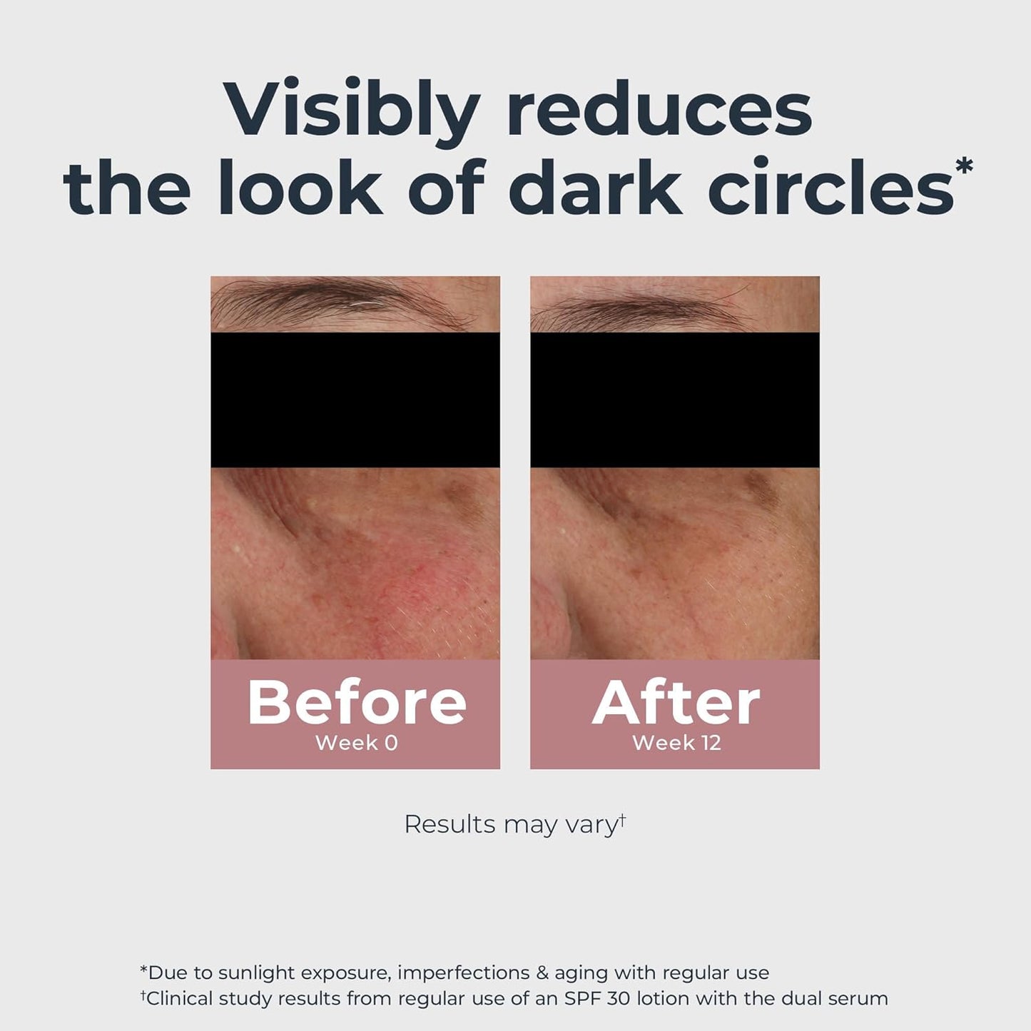 Eucerin Radiant Tone Eye Cream Dark Circle Corrector, Eye Brightening Cream with Thiamidol and Hyaluronic Acid, Helps Reduce the Look of Eye Puffiness, 0.5 Oz Tube