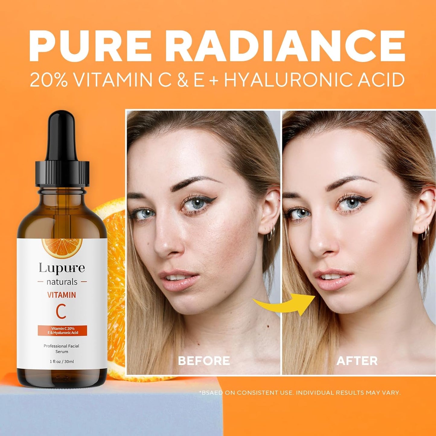 Professional Vitamin C Face Serum 20%, Anti Aging Facial Super Vit C Serum with Ascorbic Acid Hyaluronic Acid & Vitamin E for Dark Spots, Skin Care, Christmas Gift & Stocking | 1 Fl. Oz