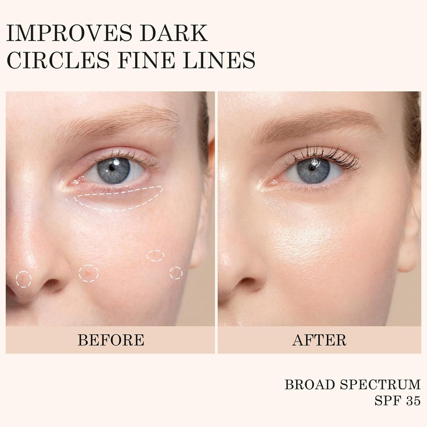 KYDA Mineral Sunscreen Eye Cream, 3-in-1 Anti-Aging Eye Cream, SPF 35, for Dark Circle and Fine Lines, Light