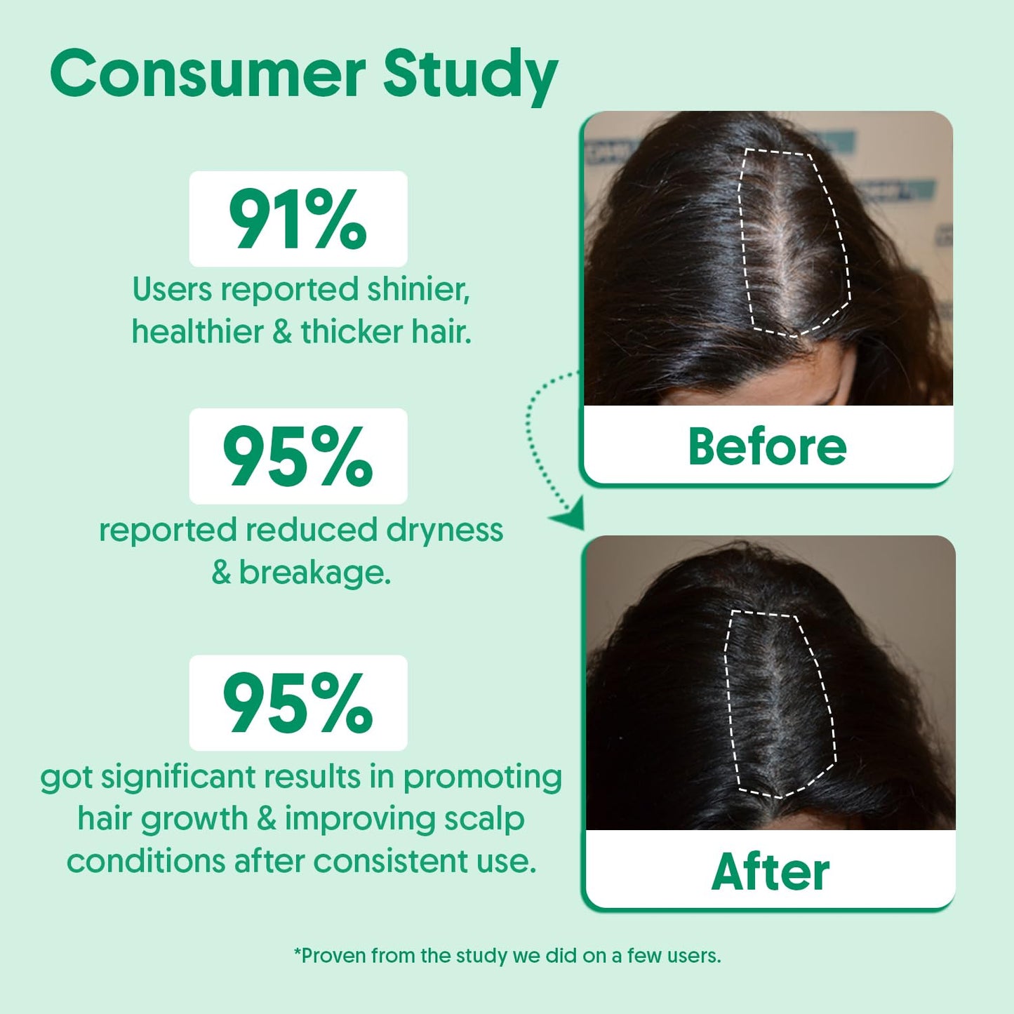 Rosemary Water Hair Spray For Hair Growth - Reducing Hair Fall, Strengthens Hair & Breakage - Promotes Healthy Follicles and Thicker Hair - For Men & Women - Fragrance Free -100 ml