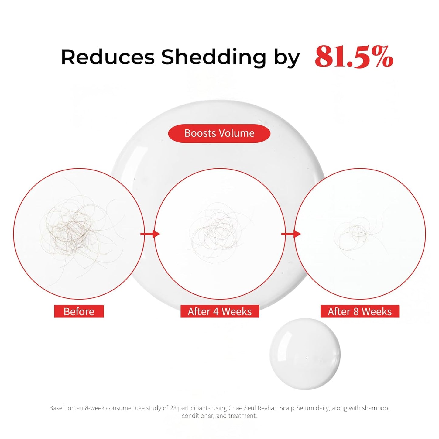 Revhan Scalp Serum for Hair Loss & Thinning – Hair Growth Serum for Men & Women w/Salicylic Acid & Centella Asiatica – Soothes Itchy, Irritated Scalp with Roll-On