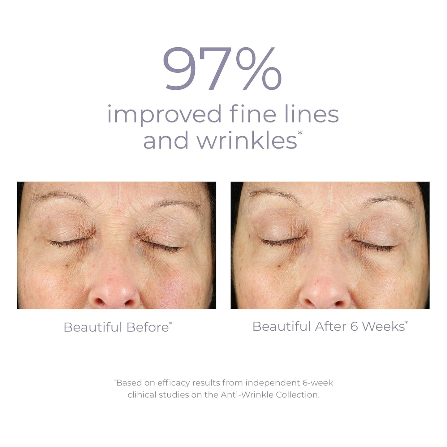 Derma E Anti-Wrinkle Eye Treatment – Anti-Aging Eye Cream with Retinol, Grape Seed Extract and Reishi Mushroom – Hydrating Eye Serum for Under Eye and Eyelids, 1/2 oz