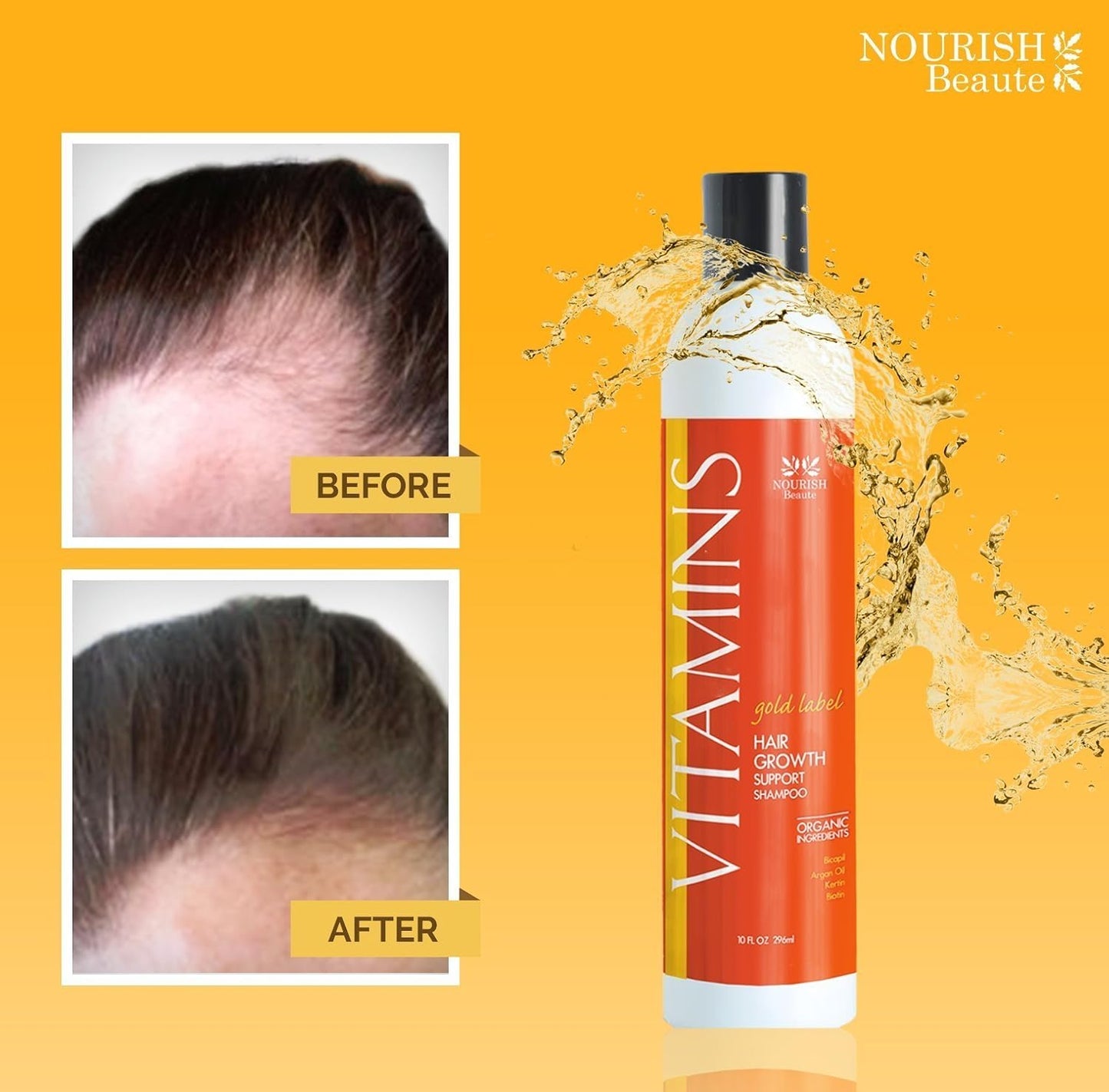 Nourish Beaute Vitamins Natural Shampoo for Hair Growth and Hair Loss for Hair Regrowth,Volume and Thickening with Biotin,DHT Blockers, No Sulfate, For Men and Women, Premium Gold Label, 3 Pk