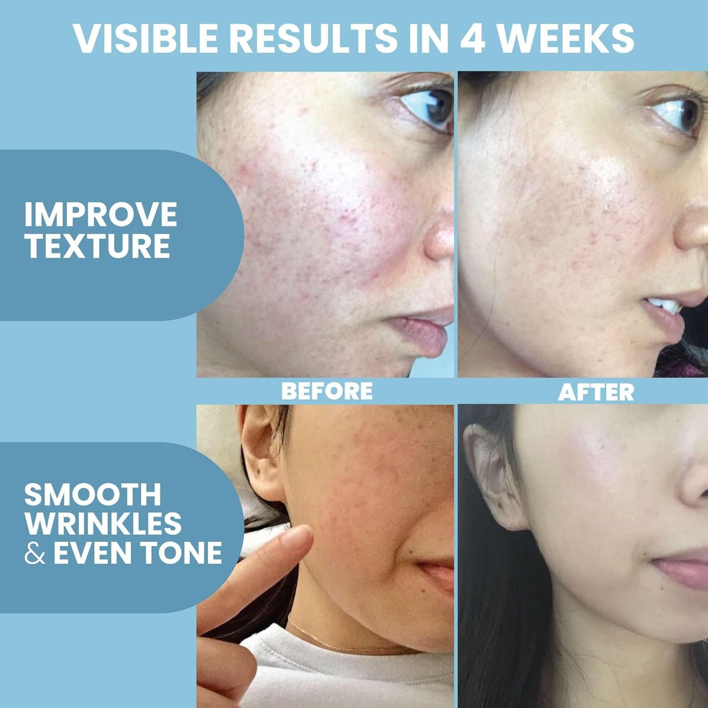 Collagen Peptide Serum for Face – Anti Aging Facial Treatment with Peptides & Hyaluronic Acid – Gentle Formula for Sensitive Skin, Microneedling Pen, Derma Roller, Skin Firming & Hydrating (2 Oz)