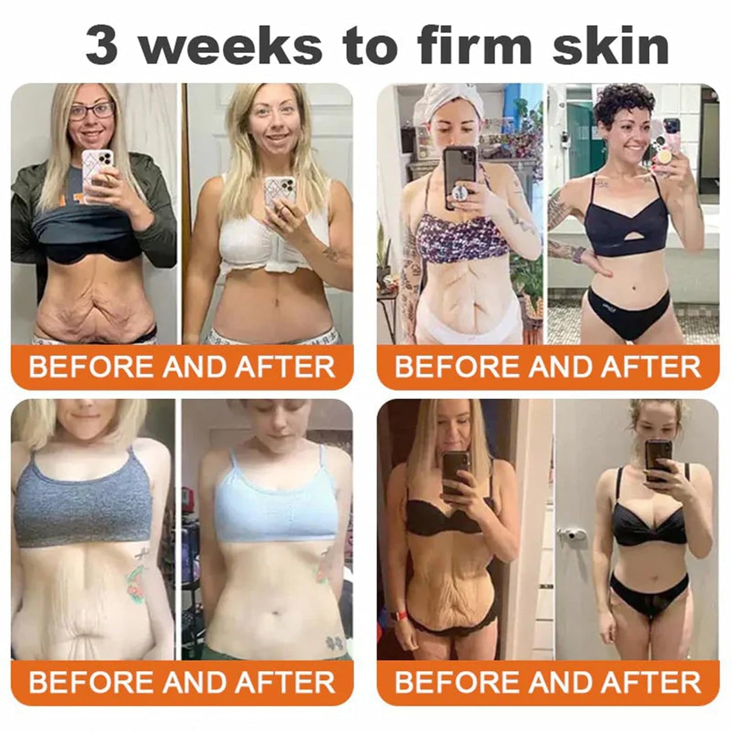 Bee Venom Skin Restoration Cream,Natural Bee Venom Comprehensive Cream,Effectively Firms skin and Reduces Imperfections Anti-Wrinkle Moisturizing for All skin Typess (2PCS)