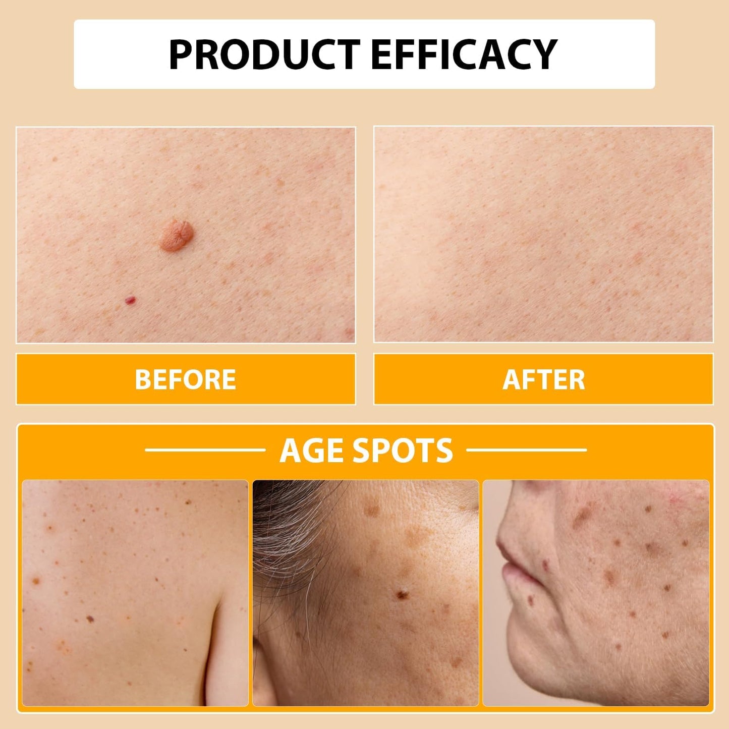 Bee Venom Cream for Removing and Repair, Moisturizing Cream for Men&Women (1Fl Oz)