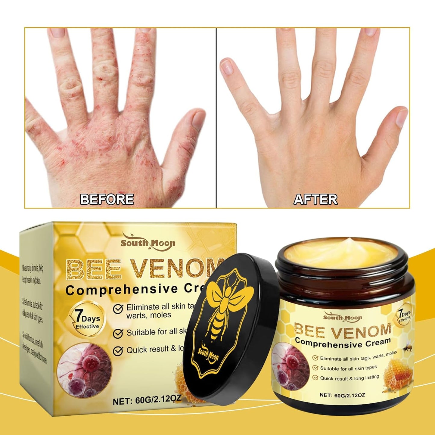 2PCS Bee Venom Skin Treatment Cream, 2025 Bee Venom Comprehensive Cream for All Skin Types, Skincare Treatment Creams, Visibly reduces blemishes