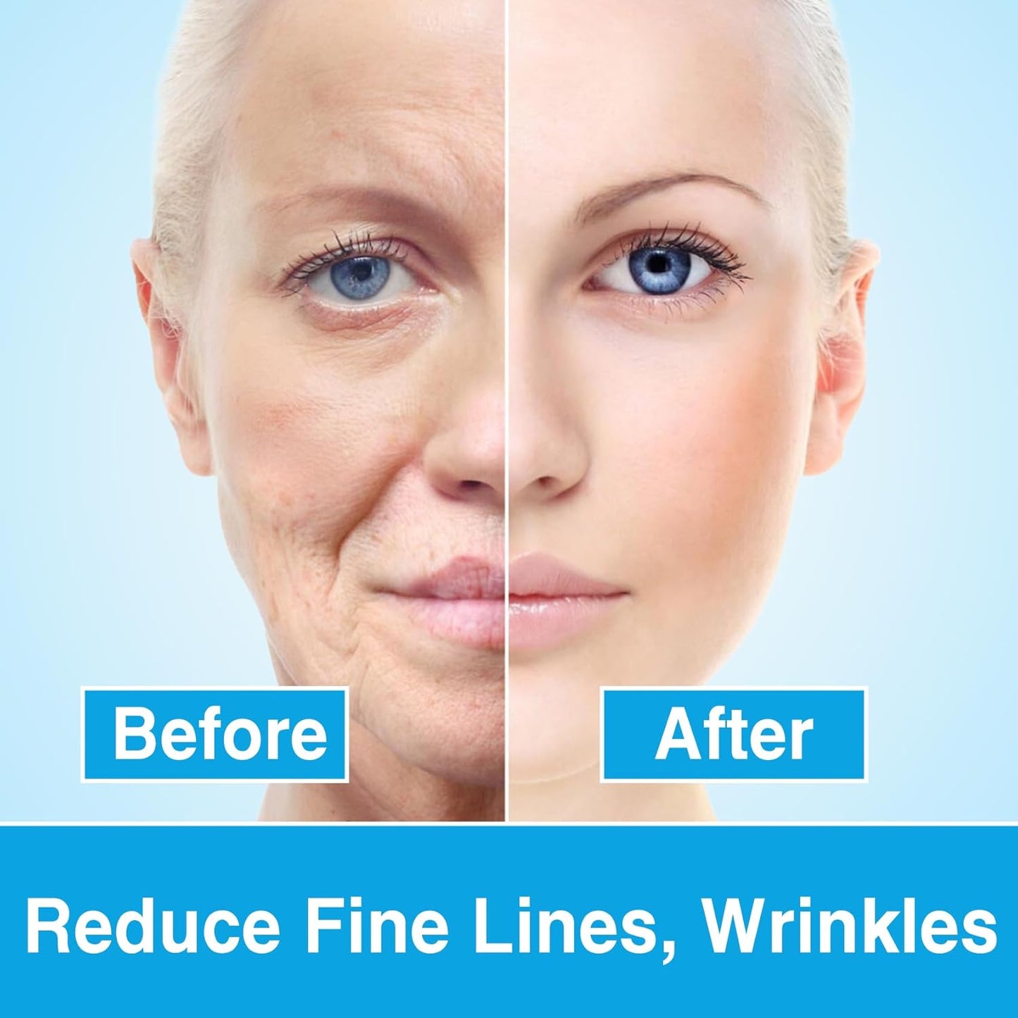 Botox Stock Solution Facial Serum, Botox Face Serum for All Skin Types, Vitamin C & Hyaluronic Acid Face Serum for Women, Reduce Wrinkles & Fine Lines, Plump Skin