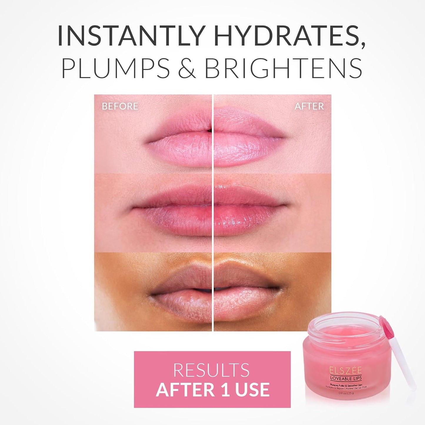ELSZÉE Loveable Lips | Lip Mask with Hyaluronic Acid | Smooth, Volumize and Hydrate Dry Lips | Day & Night Treatment