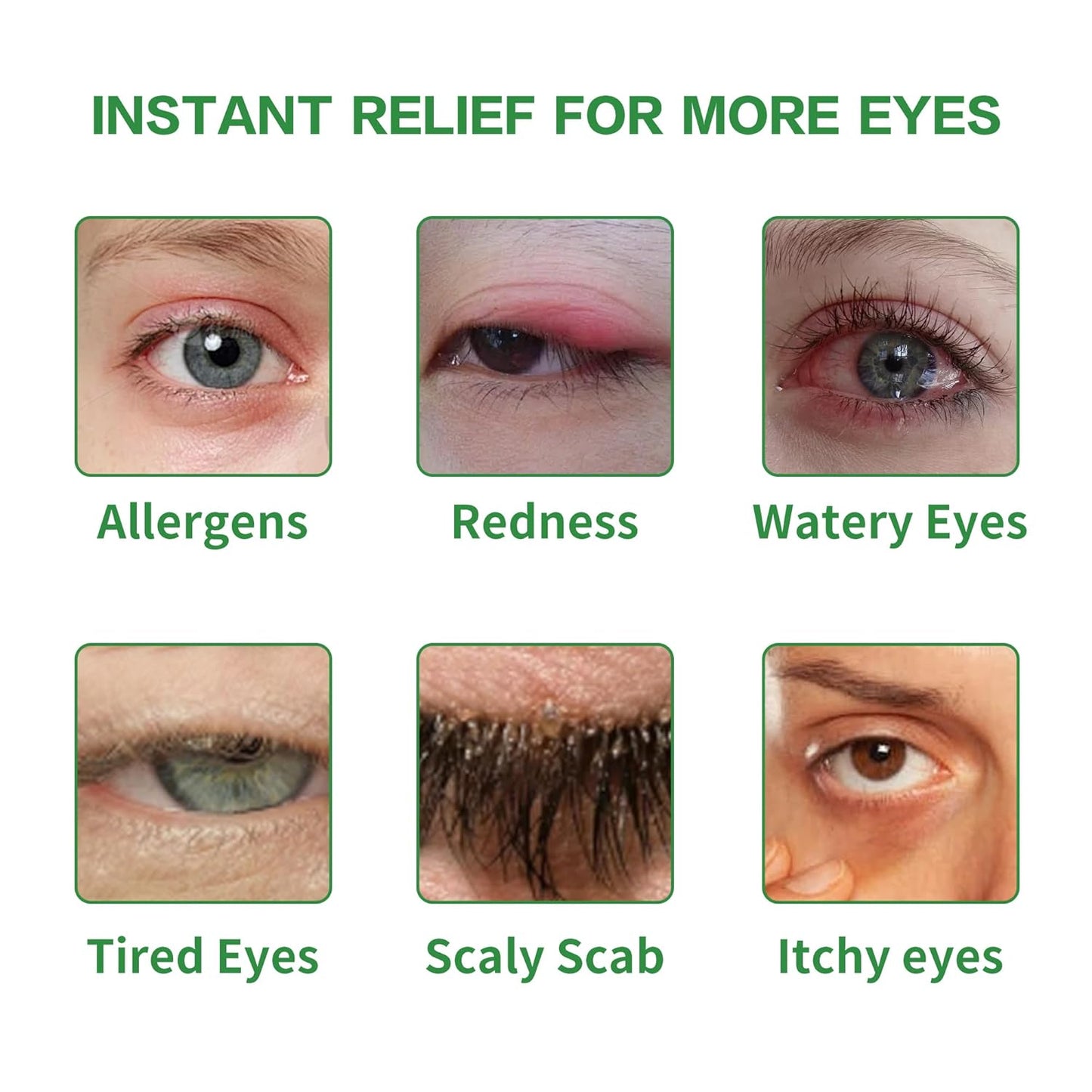 Okra Eye Care Patch, with Abelmoschus esculentus & Propanediol, Effective Relief for Itchy, Dry Eyes, Hypoallergenic & Soothing for Sensitive Eyes, Individually Wrapped, Pack of 14