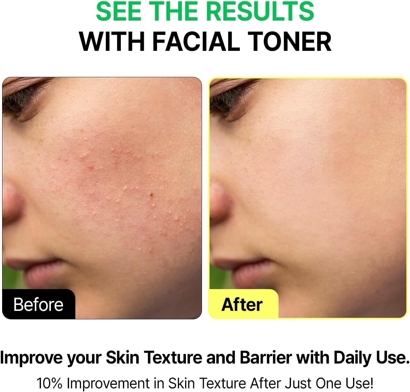 VEGANIFCET Essence, Ultra Hydrating, for Glowing Skin, Korean Skin Care, Vegan, 6.76 Fl Oz