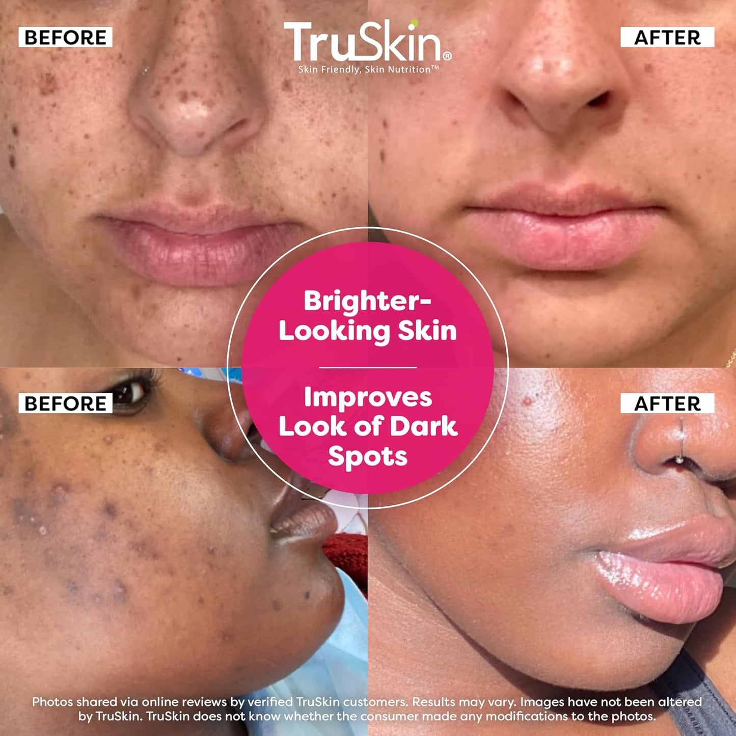 TruSkin Vitamin C Super Serum - Niacinamide, Retinol, Hyaluronic & Salicylic Acid - All-in-One Anti Aging Serum for Face – Improve Appearance of Dark Spots, Firmness for Brighter Looking Skin, 2 Fl Oz