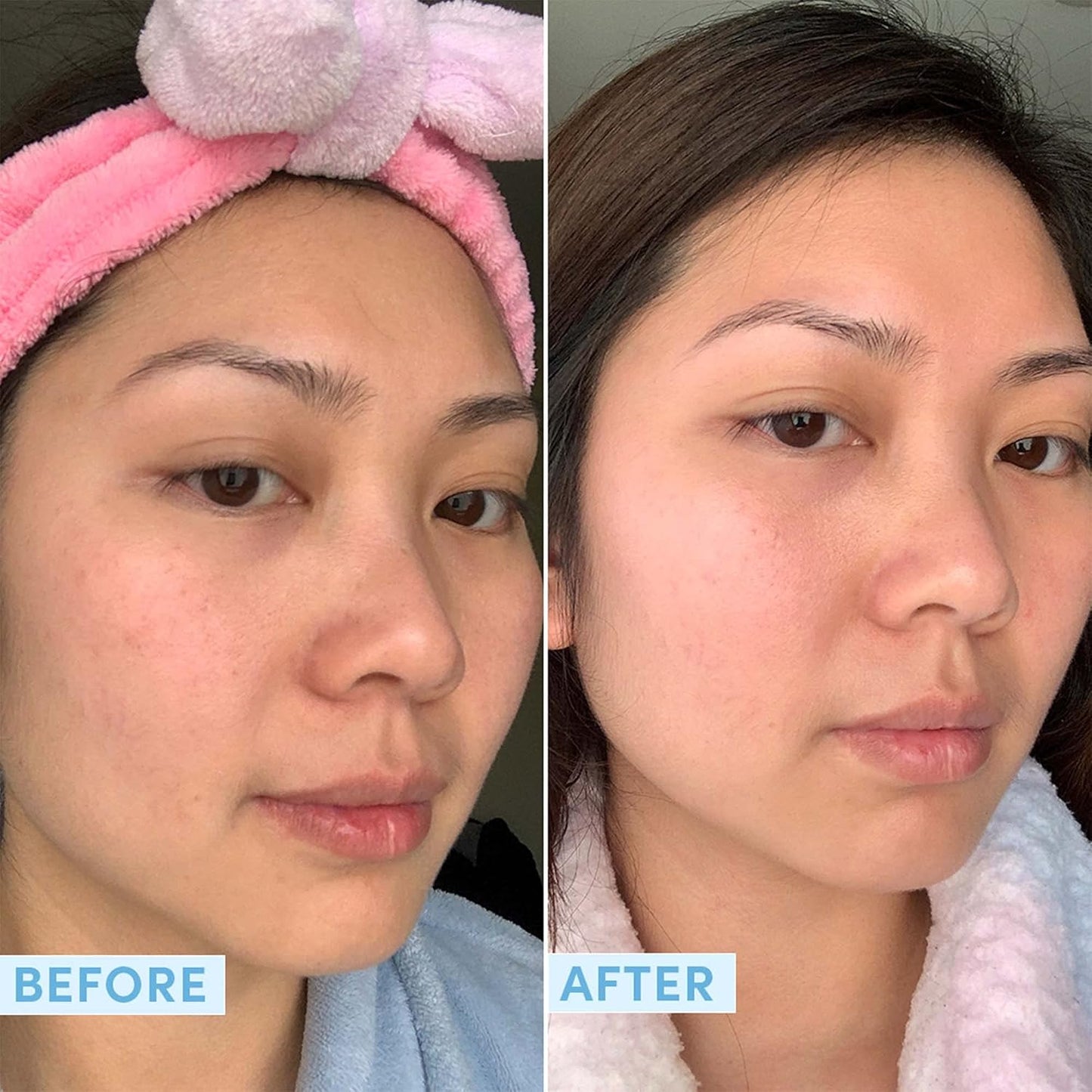 Sand & Sky Tasmanian Spring Water Hydrating Serum with Hyaluronic Acid & Probiotics - Fine Line Reducing Face Serum, Plumps Skin & Smooths Wrinkles, 1 fl oz