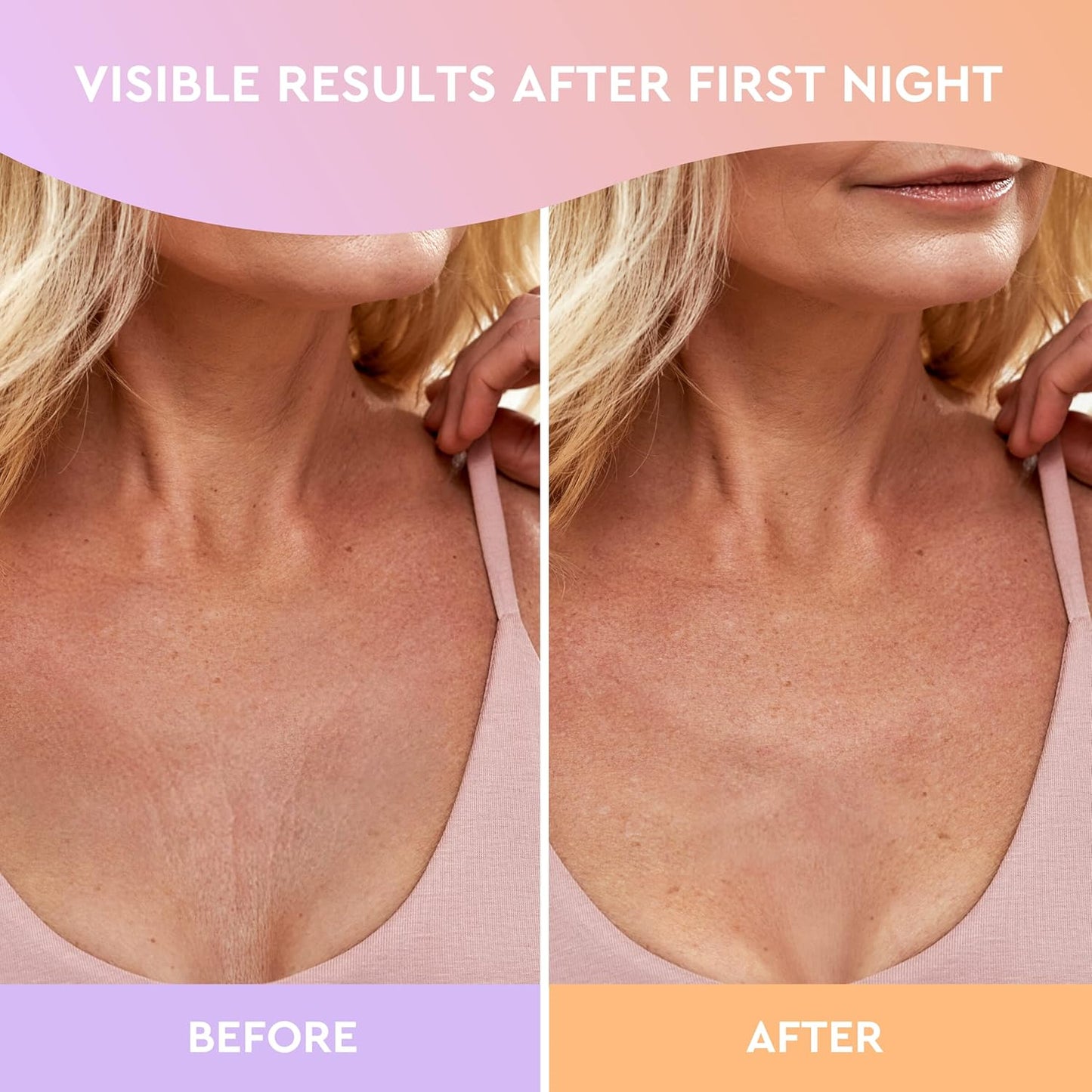 CLEVERFY Silicone Chest Wrinkle Pads Sleeping Reusable (2 Pack V-shape) - Decollete Anti Wrinkle Chest Pads - Silicone Patches for Wrinkles - Anti Wrinkle Patches for Decollete Wrinkle Prevention