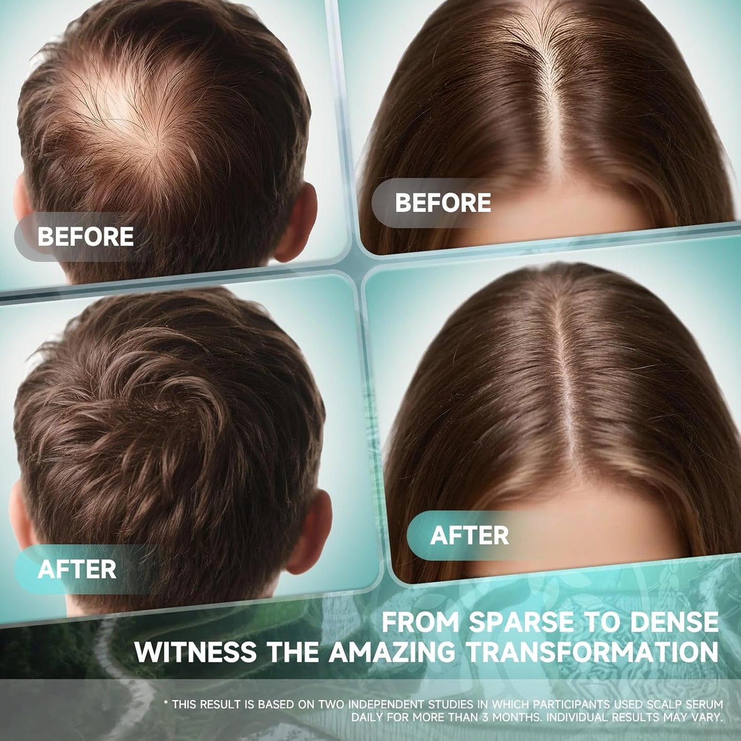 Hair Growth Serum - Rosemary Batana Rice Water Biotin Hair Spray for Hair Growth - Hair Growth Thickening Product - Hair Loss Treatments for Women Men(60 ML/2.0FL.oz)