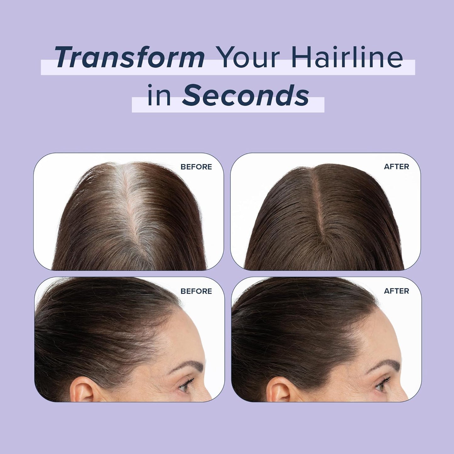 TRUHAIR Root & Scalp Cover Up Pressed Powder Compact Refill, Waterproof, Weightless Hair Coverage & Bald Spot Concealing, Root Touch Up Hair Color for Gray Coverage & Thinning Areas, 0.35 Oz (Auburn)