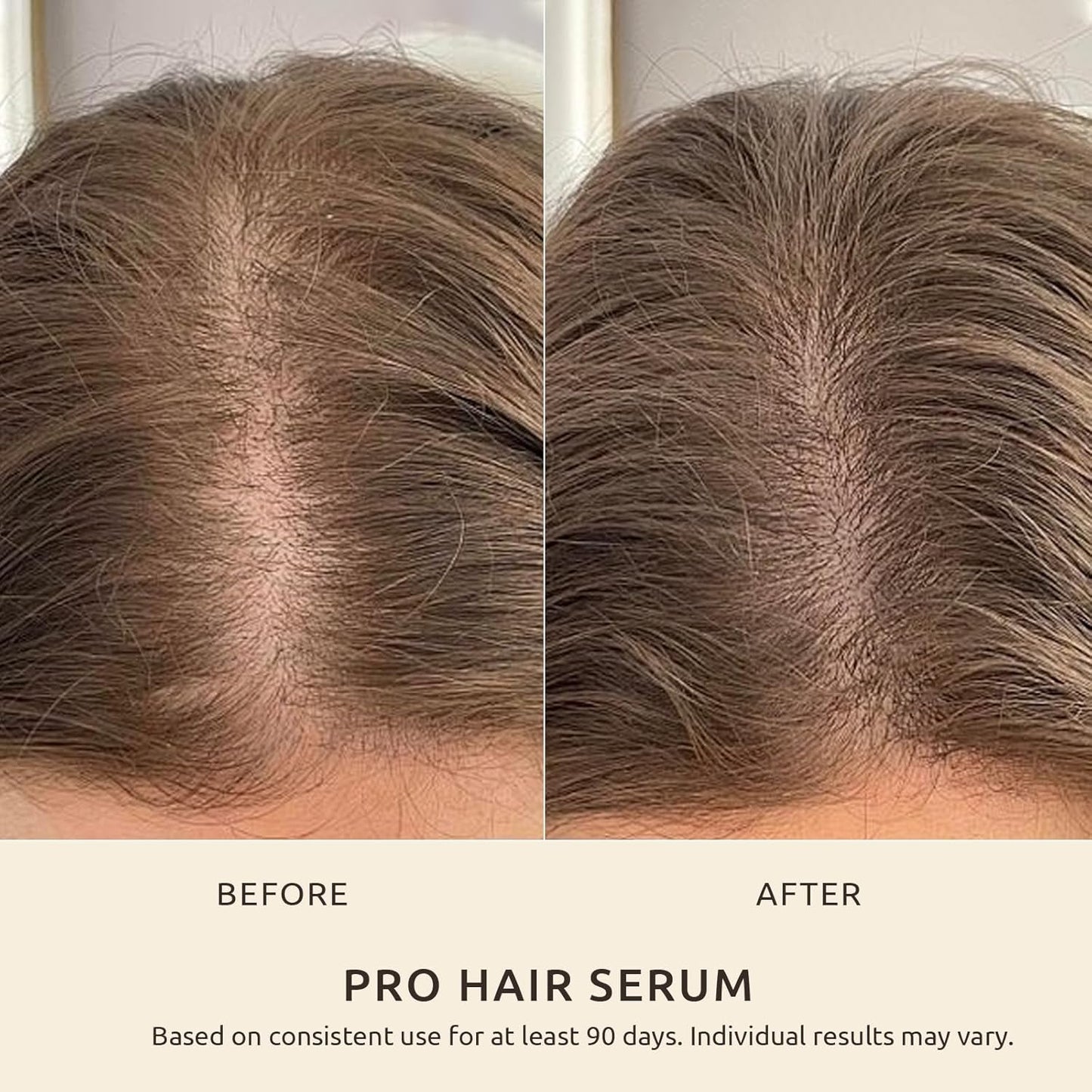 Hair Loss & Thinning Treatment for Women and Men, Scalp Serum for Thicker Fuller Hair in 90 Days, Water Based, No Oily Feeling