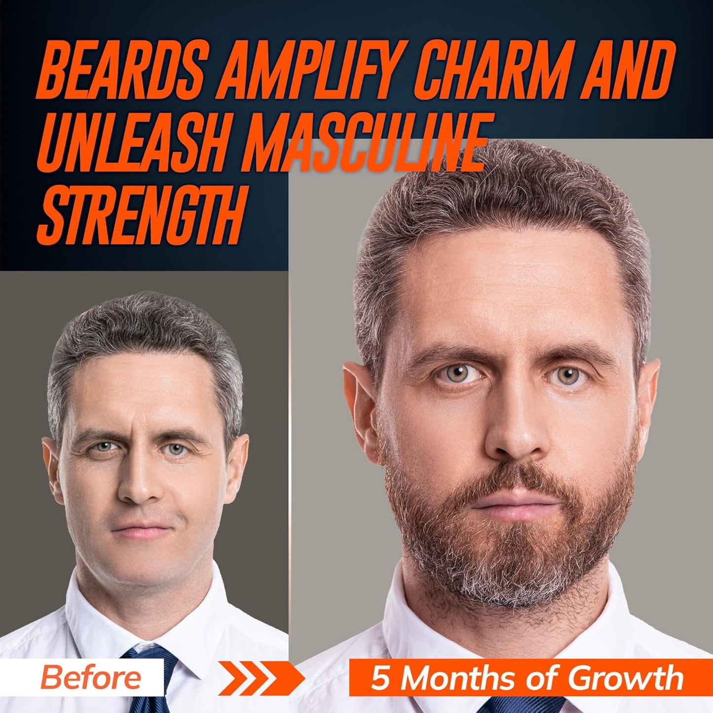 5% Minoxidil Beard Growth Serum for Men: Hair Regrowth Spray with Biotin & Rice Water - Extra Strength Beard Oil for Faster Thicker and Fuller Beard Growth - 2.03 Fl Oz