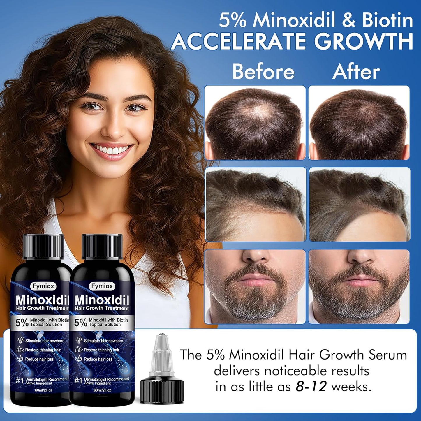 5% Minoxidil for Men and Women Hair Growth Oil, Monoxide Beard Hair Growth Serum Products, Hair Regrowth Treatment for Hair Loss, Thicker Fuller Hair (2 x 60ML)